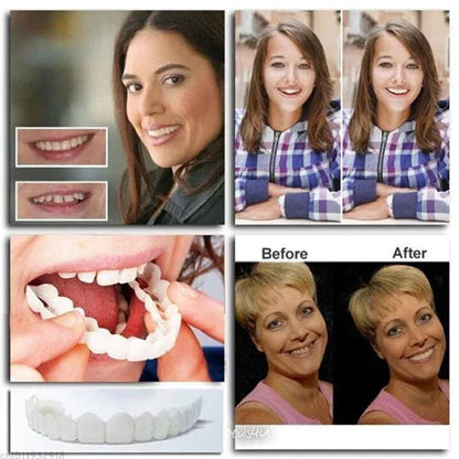 Seurico Smile Snap-On Gebit | 1+1 Gratis