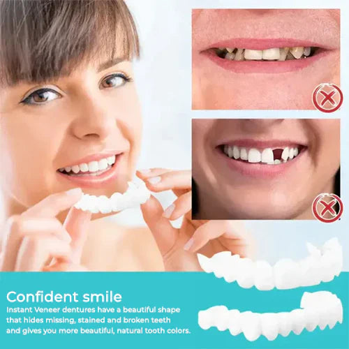 Seurico Smile Snap-On Gebit | 1+1 Gratis