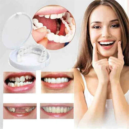 Seurico Smile Snap-On Gebit | 1+1 Gratis